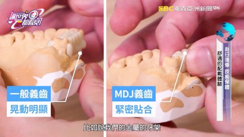 讓世界都看見-台灣好品牌-電視節目專訪-「齒匠」- 製作單位：星澤影視 製作人：游祈盛、楊含容