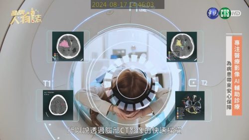 讓世界都看見-台灣好品牌-電視節目專訪-「醫揚科技股份有限公司」- 製作單位：星澤影視 製作人：游祈盛、楊含容